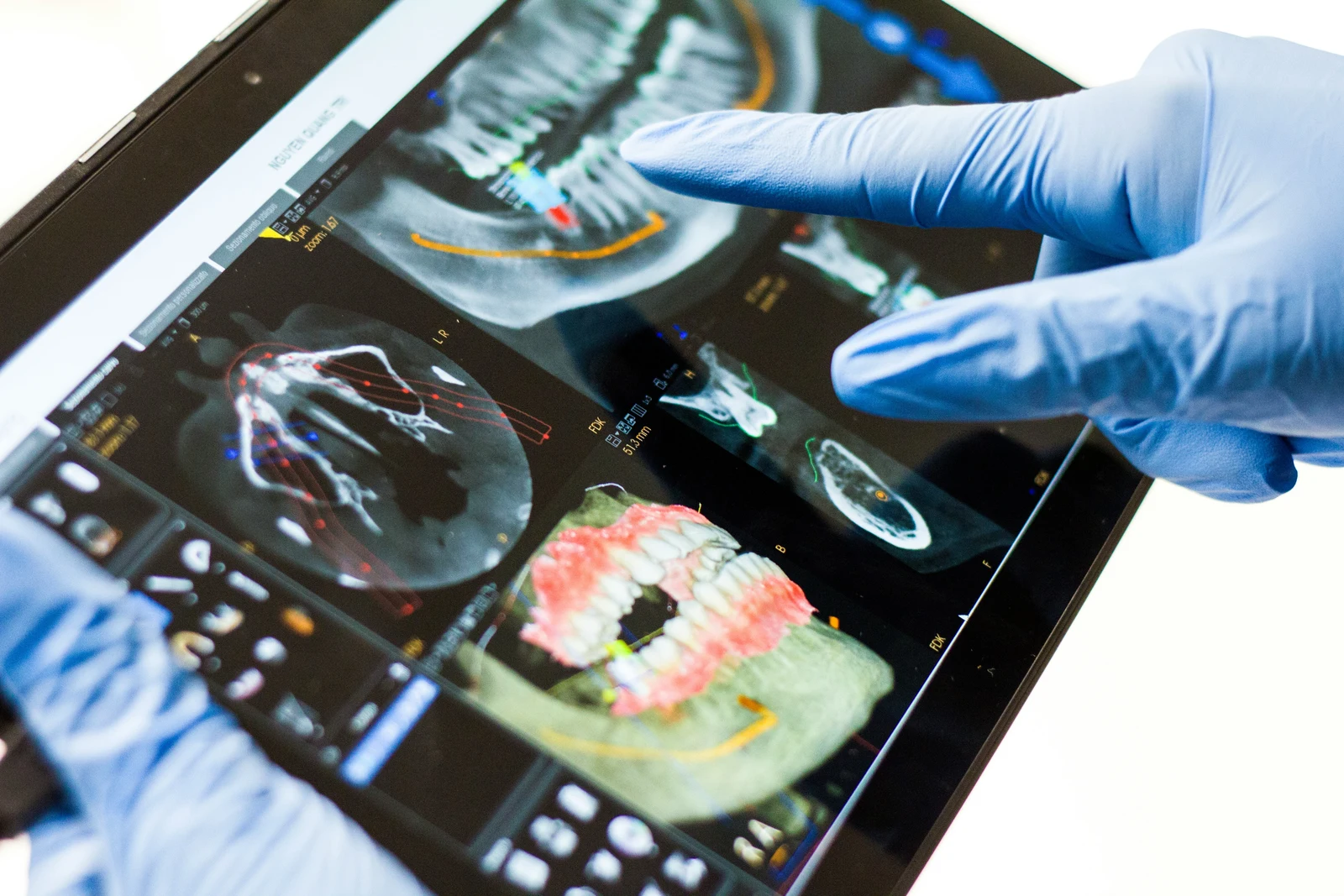 Why Regular Dental Checkups Are Essential for Your Oral Health
