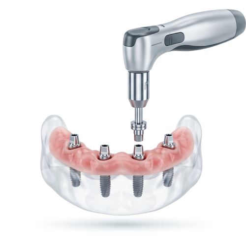 step_02-500x500 Dental Service